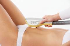 cancer-de-piele-epilare-definitiva